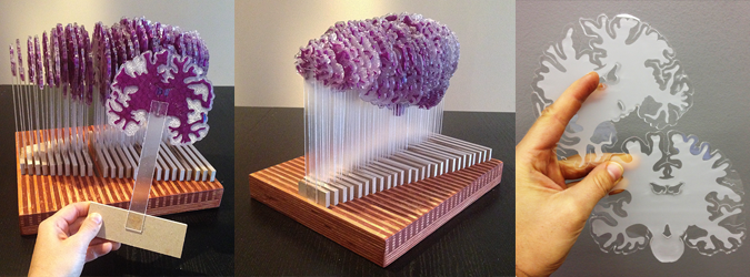 Brain Slices Tool